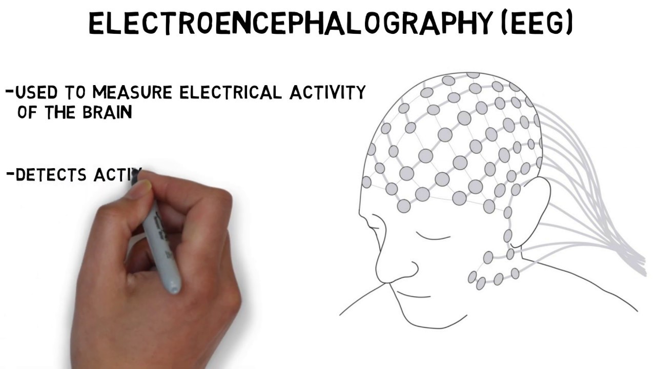 eeg medical abbreviation